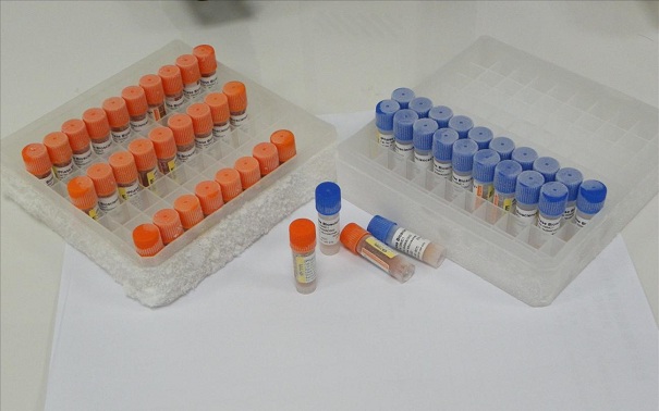 生物指示劑有哪些分類？它的應(yīng)用情況是這樣的！