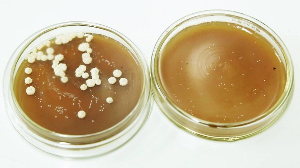 常見微生物菌種的種類有哪些？它應(yīng)該這樣去進(jìn)行保存！
