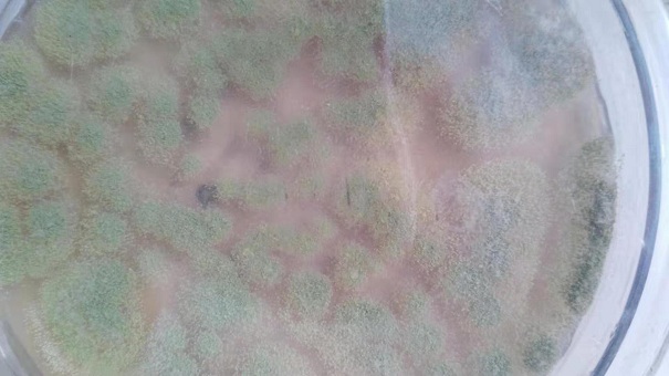 微生物菌種的復(fù)合功效是什么？這些因素在影響它的生長(zhǎng)！