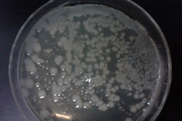 微生物菌種在農(nóng)業(yè)方面有什么作用？農(nóng)業(yè)會使用這些類型！